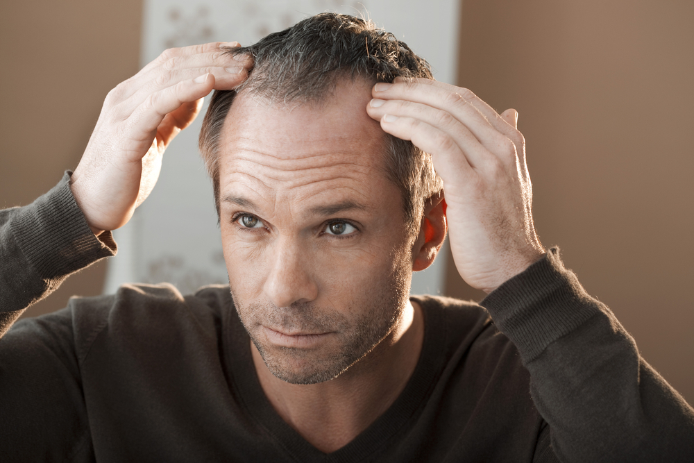 Was sind die Ursachen von Haarausfall?