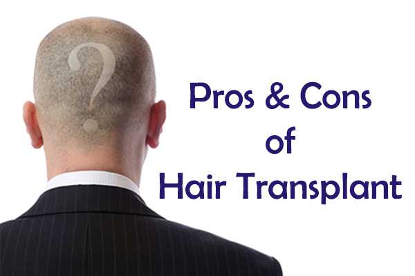 Hair Transplant Pros and Cons